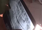 Cabut Gigi Berujung Maut, Ini Kronologinya