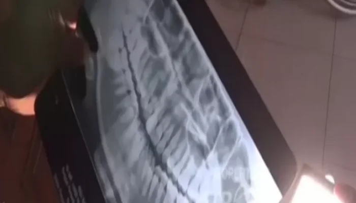 Cabut Gigi Berujung Maut, Ini Kronologinya