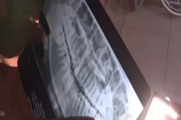 Cabut Gigi Berujung Maut, Ini Kronologinya