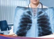 Pemicu Paru-paru Basah salah satunya karena AC, Ini kata Dokter