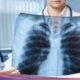 Pemicu Paru-paru Basah salah satunya karena AC, Ini kata Dokter