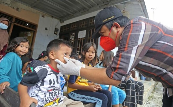 Waspada, Gejala hepatitis pada anak yang sering diabaikan orang tua  
