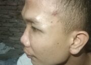 Oknum TNI AD Pukuli Warga Medan Johor