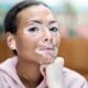 Apa itu Vitiligo dan Apakah Bisa Diobati? Ini Kata Dokter