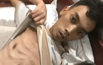 Dikabarkan Meninggal di Kamboja, Begini Kondisi Terkini Rico Warga Tebing Tinggi