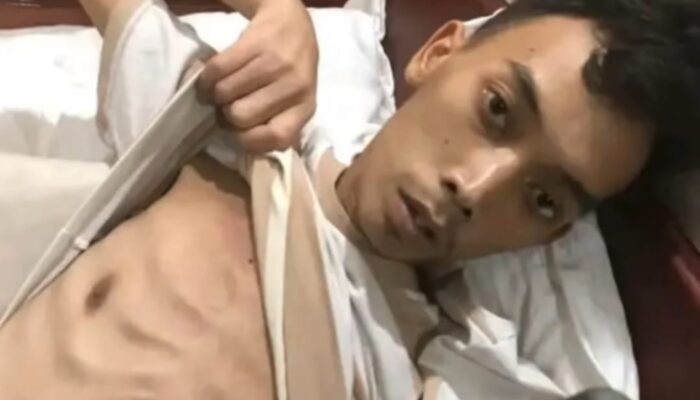 Dikabarkan Meninggal di Kamboja, Begini Kondisi Terkini Rico Warga Tebing Tinggi