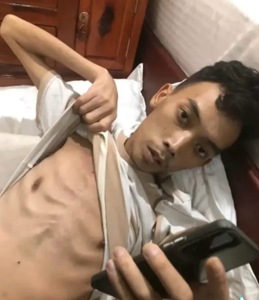 Dikabarkan Meninggal di Kamboja, Begini Kondisi Terkini Rico Warga Tebing Tinggi