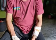 Nyaris Jadi Korban Begal, Warga Pasar Baru Luka Akibat Bacokan Celurit