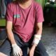 Nyaris Jadi Korban Begal, Warga Pasar Baru Luka Akibat Bacokan Celurit