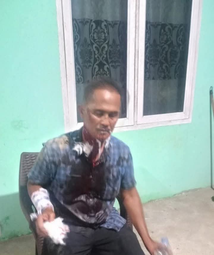 Tukang Ojek di Sergai Jadi Korban Perampokan, Pelaku Ditangkap