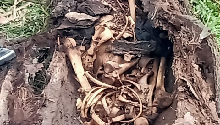 Sergai Heboh, Kerangka Manusia Menumpuk Dalam Pohon Aren.